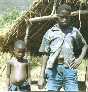 Fake Medicines – Massive Killer of African Children