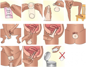 how to use a condom