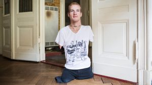 Born Without Arms Or Legs: ‘I’m Glad I Don’t Need Any Shoes’